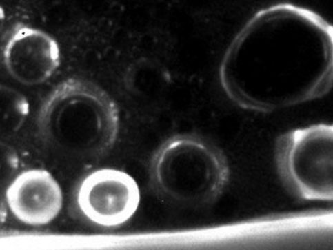 Mikroskopische Aufnahme der Tautropfen mit fluoreszierender DNA